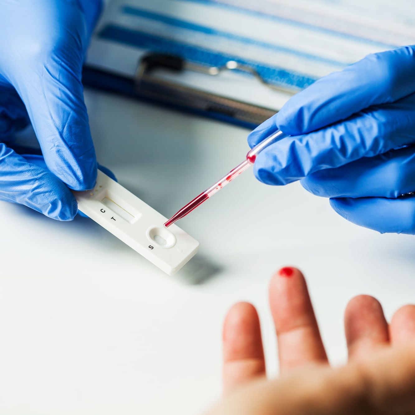 in-vitro diagnostics